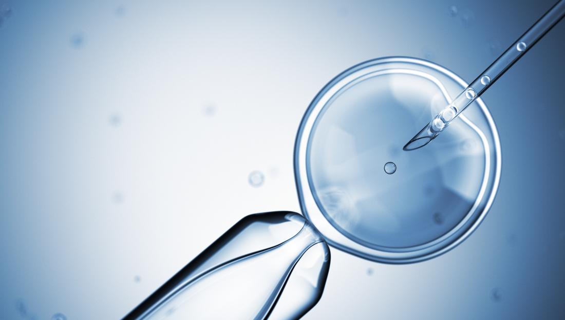artificial insemination