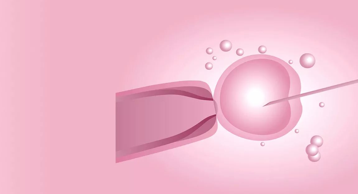 egg donation