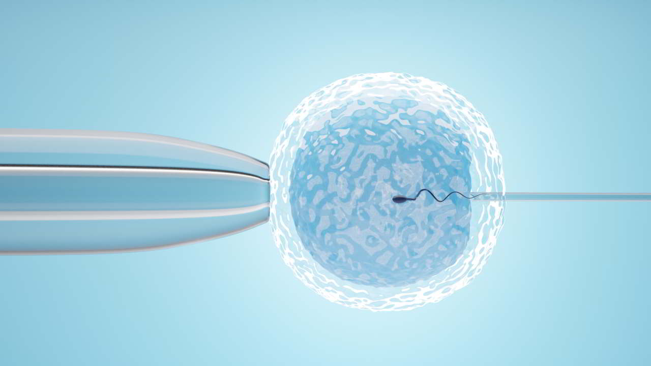 intrauterine insemination (iui) treatment